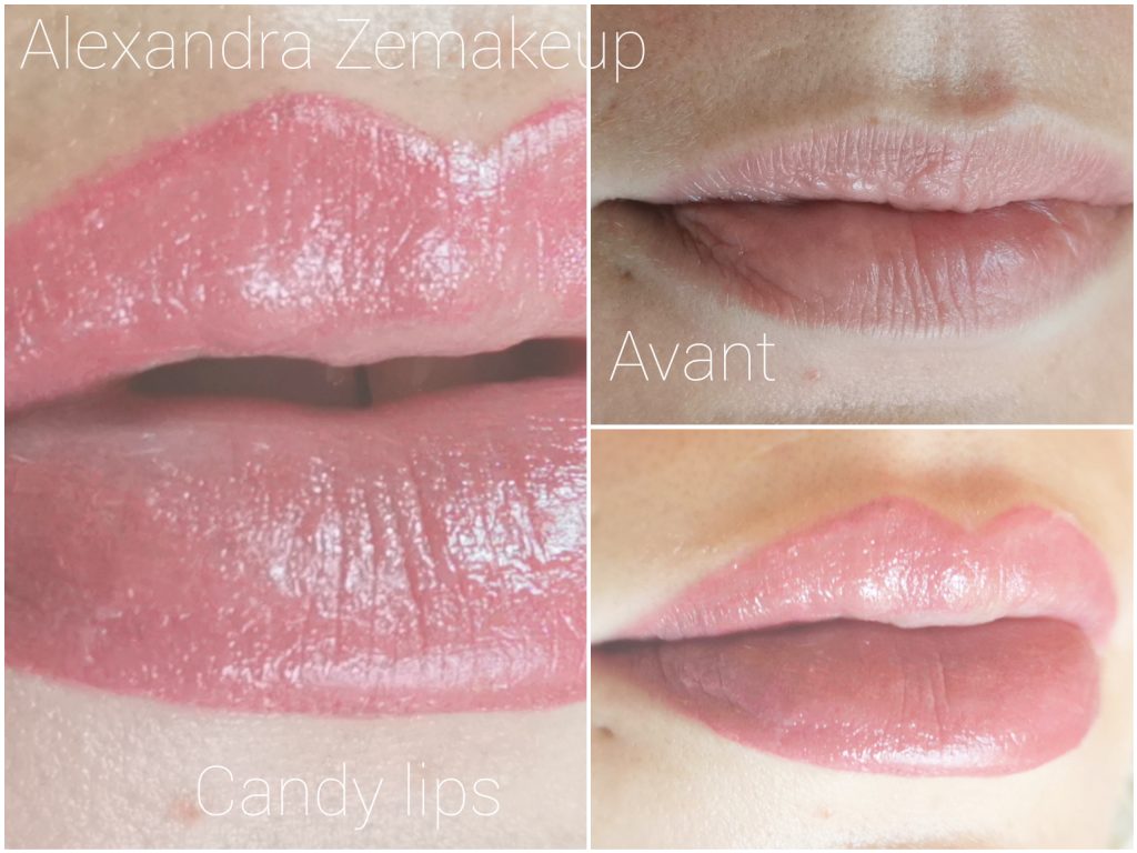 candy lips avant/après