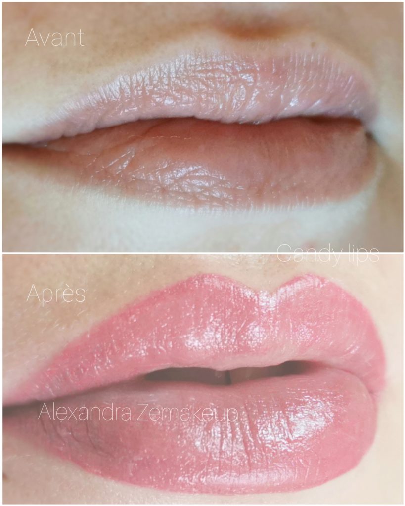Lèvres avant/après