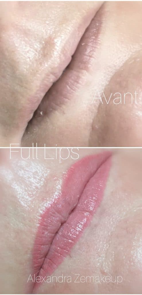 full lips avant/après