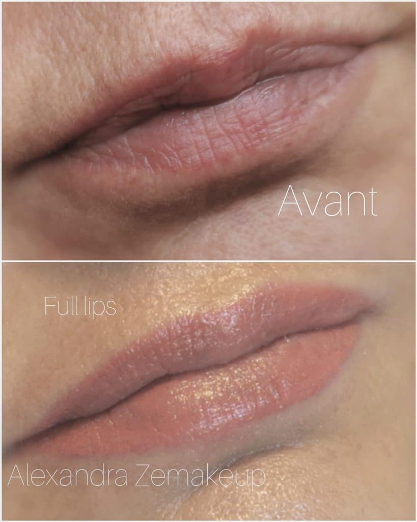 full lips avant/après