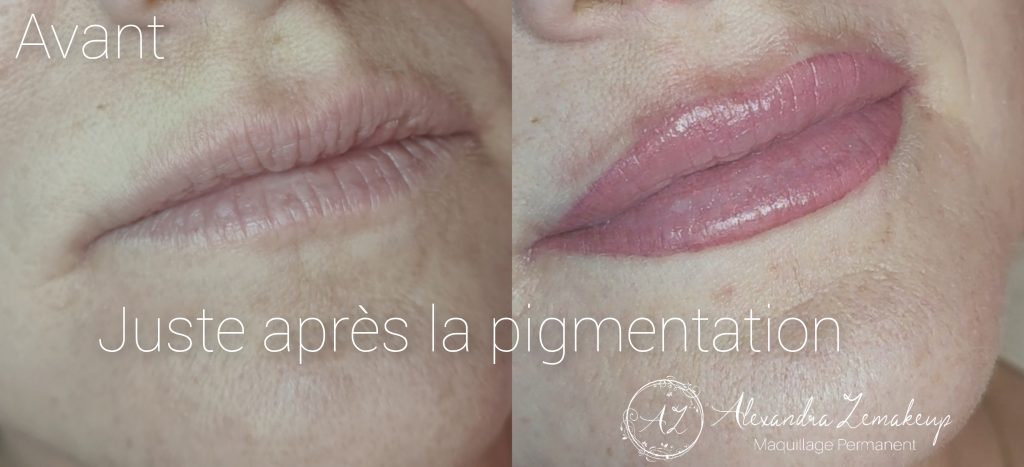 pigmentation des lèvres, correction asymétrie et coloration de la lèvre complète